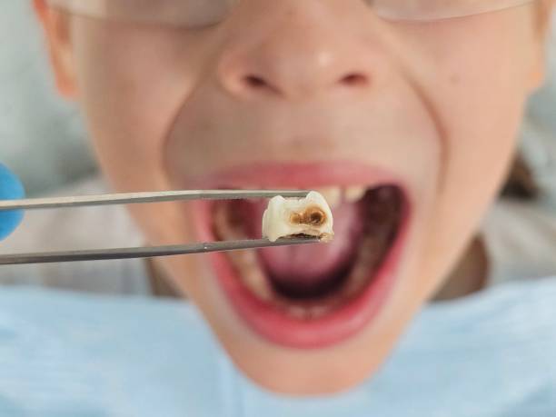 Best Emergency Gum Treatment in Briar, TX